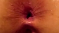Husband Anal Fuck Wife Asshole Raw & Crempie Inside Of Her hd husband anal fuck wife asshole raw crempie inside of her best